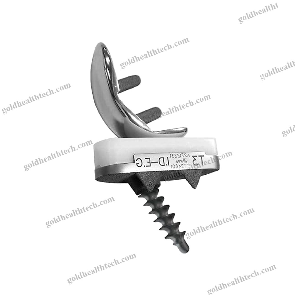 Unicompartmental Knee Prosthesis