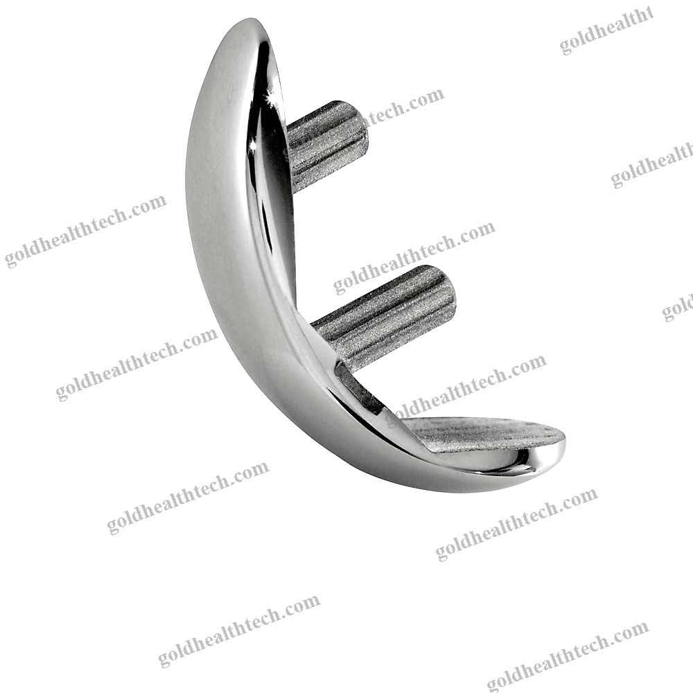 Unicompartmental Knee Prosthesis