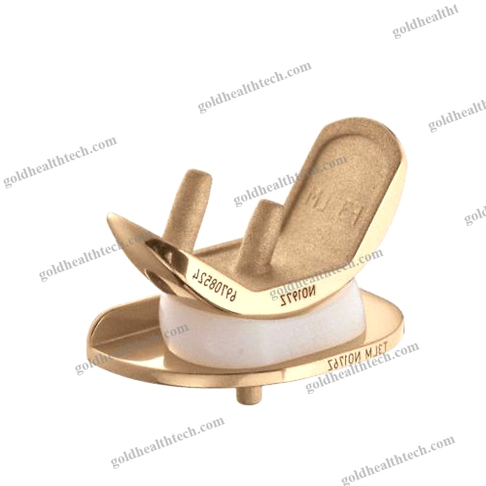 Unicompartmental Knee Prosthesis 1