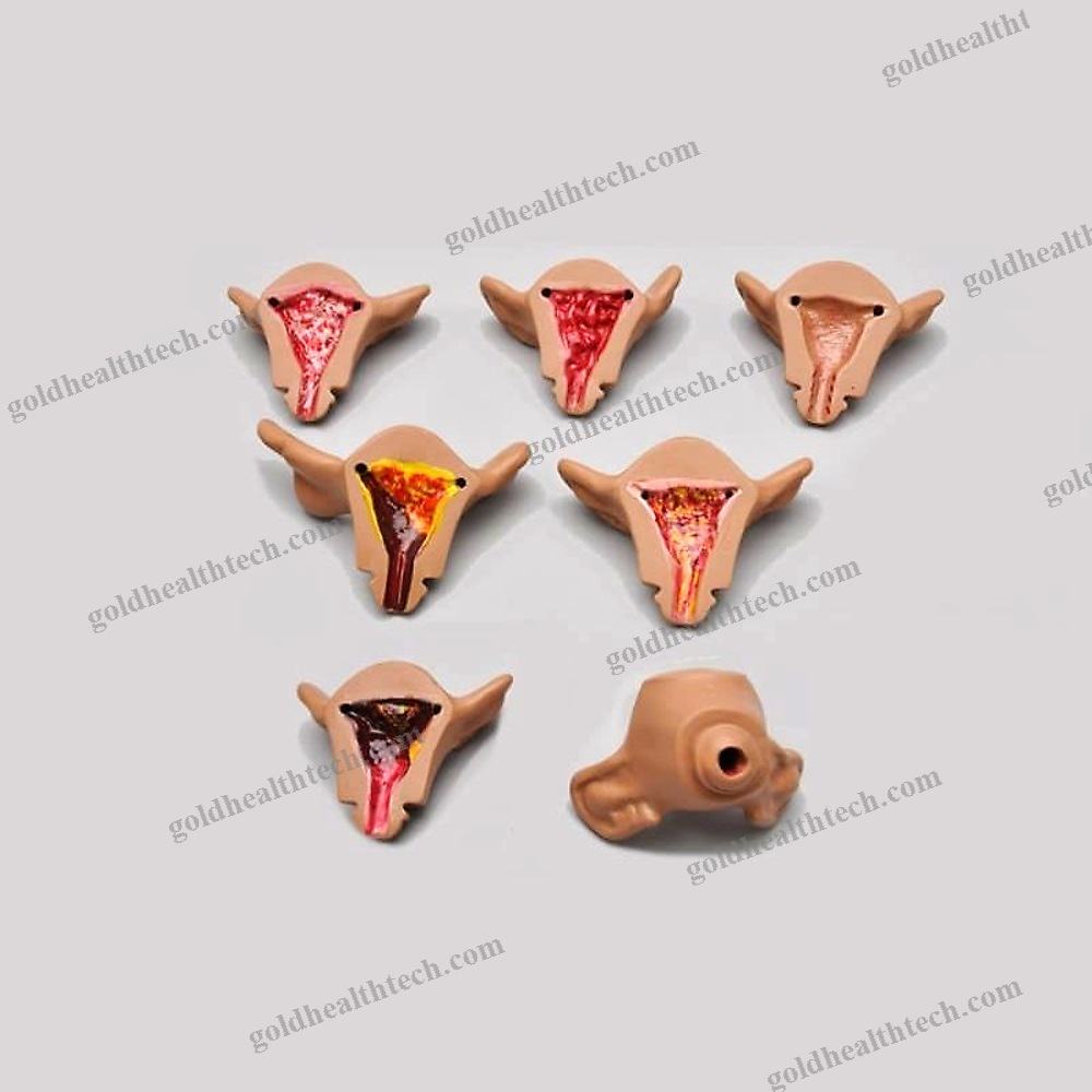 Uterus Model