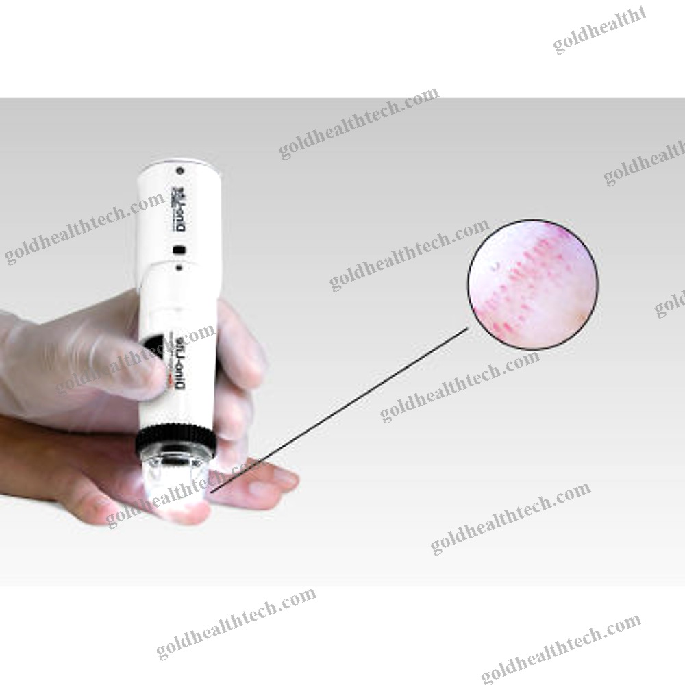 Video Capillaroscope 1