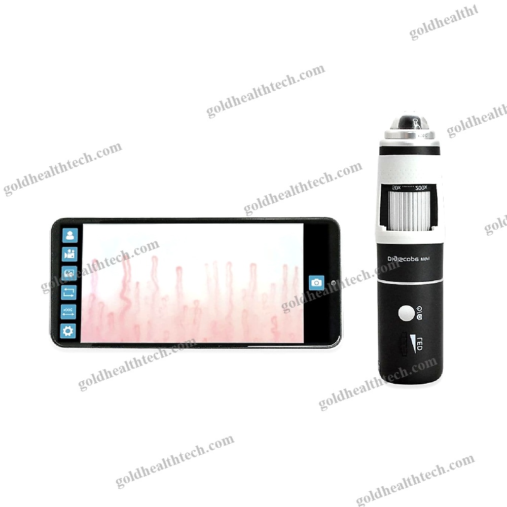 Video Capillaroscope