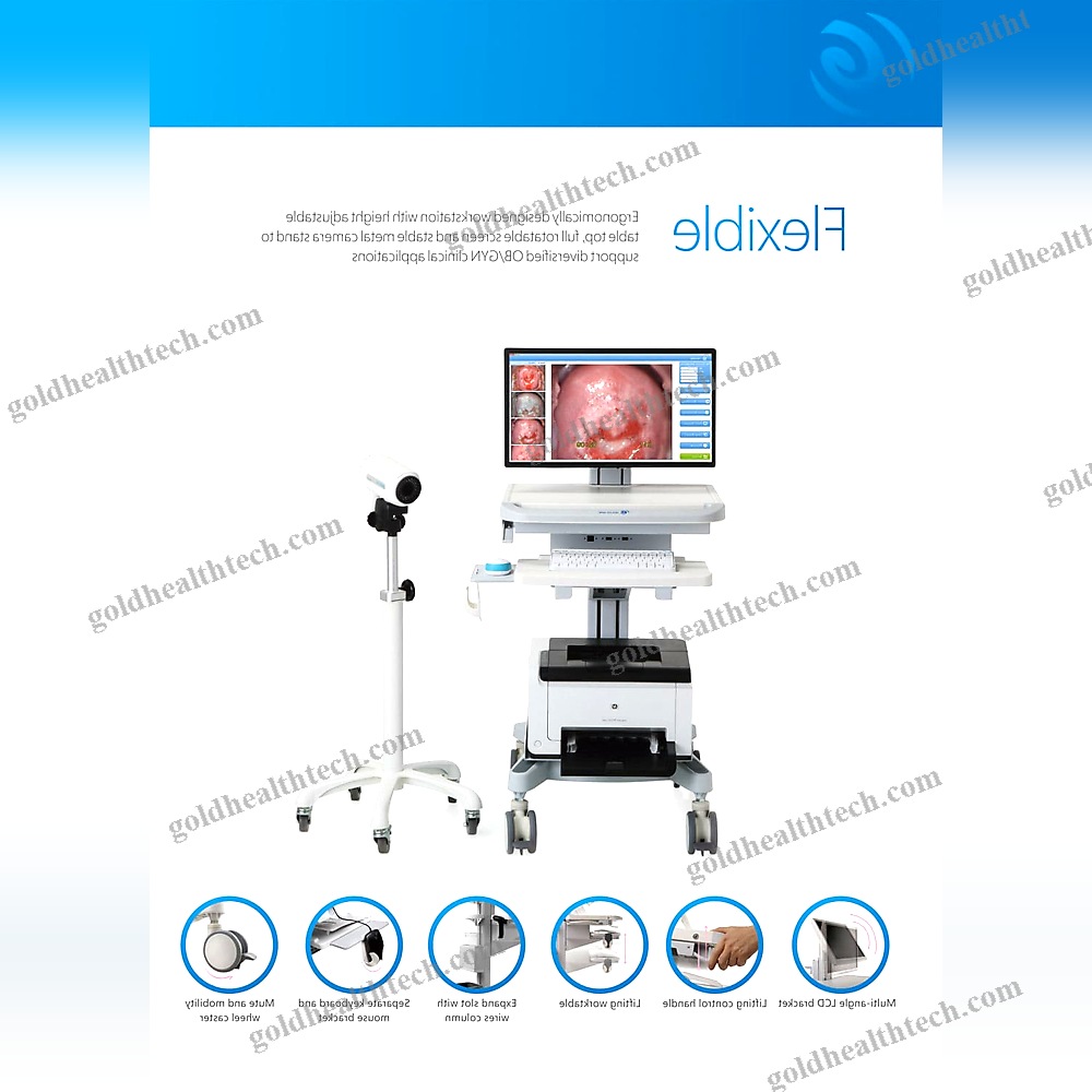 Video Colposcope 1