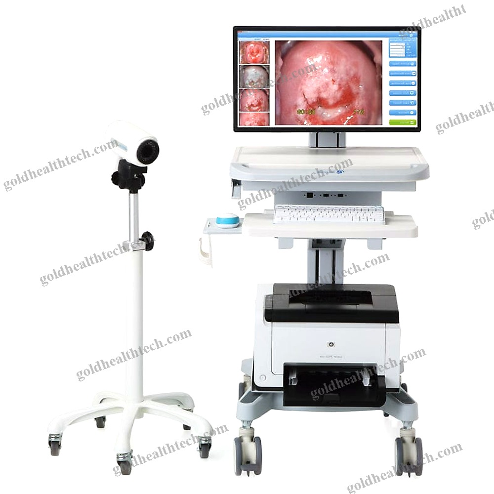 Video Colposcope