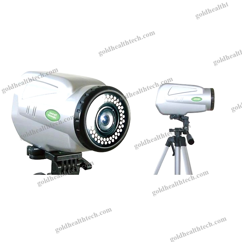 Video Colposcope