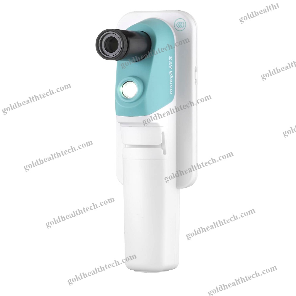 Video Colposcope