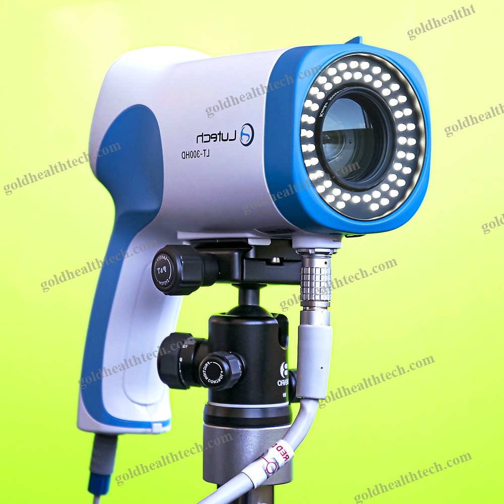Video Colposcope