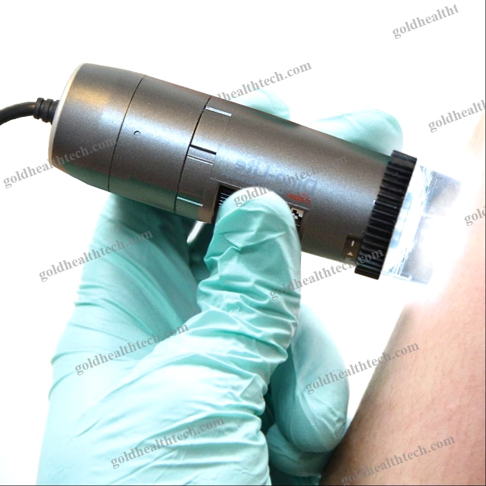 Video Dermatoscope