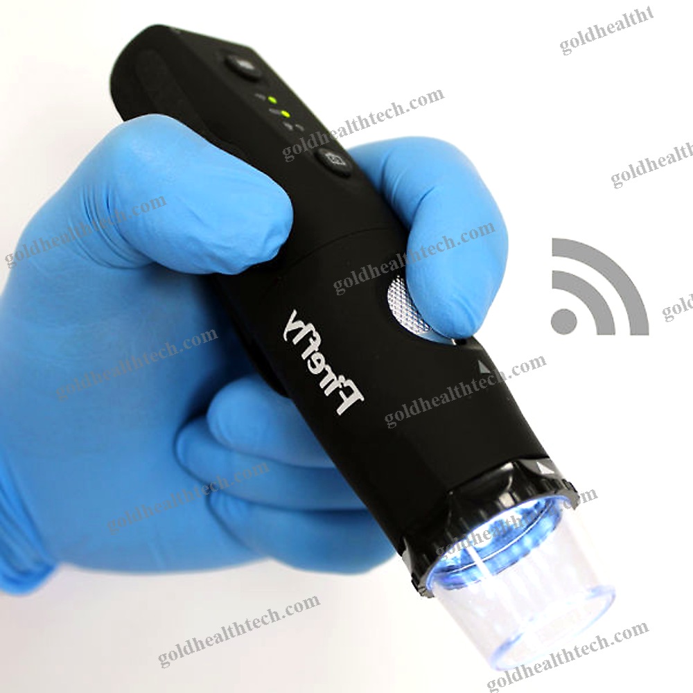 Video Dermatoscope