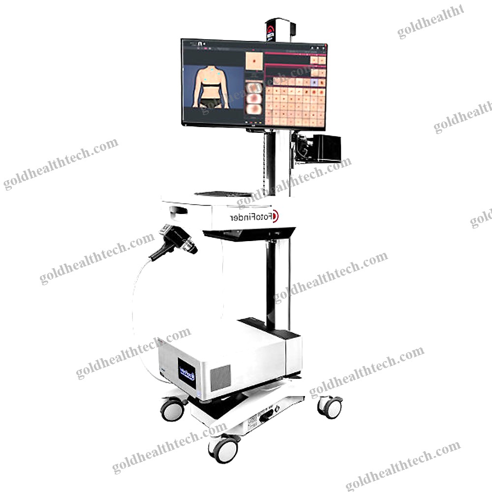 Video Dermatoscope