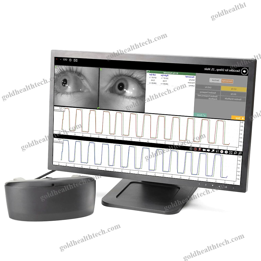 Videonystagmography System