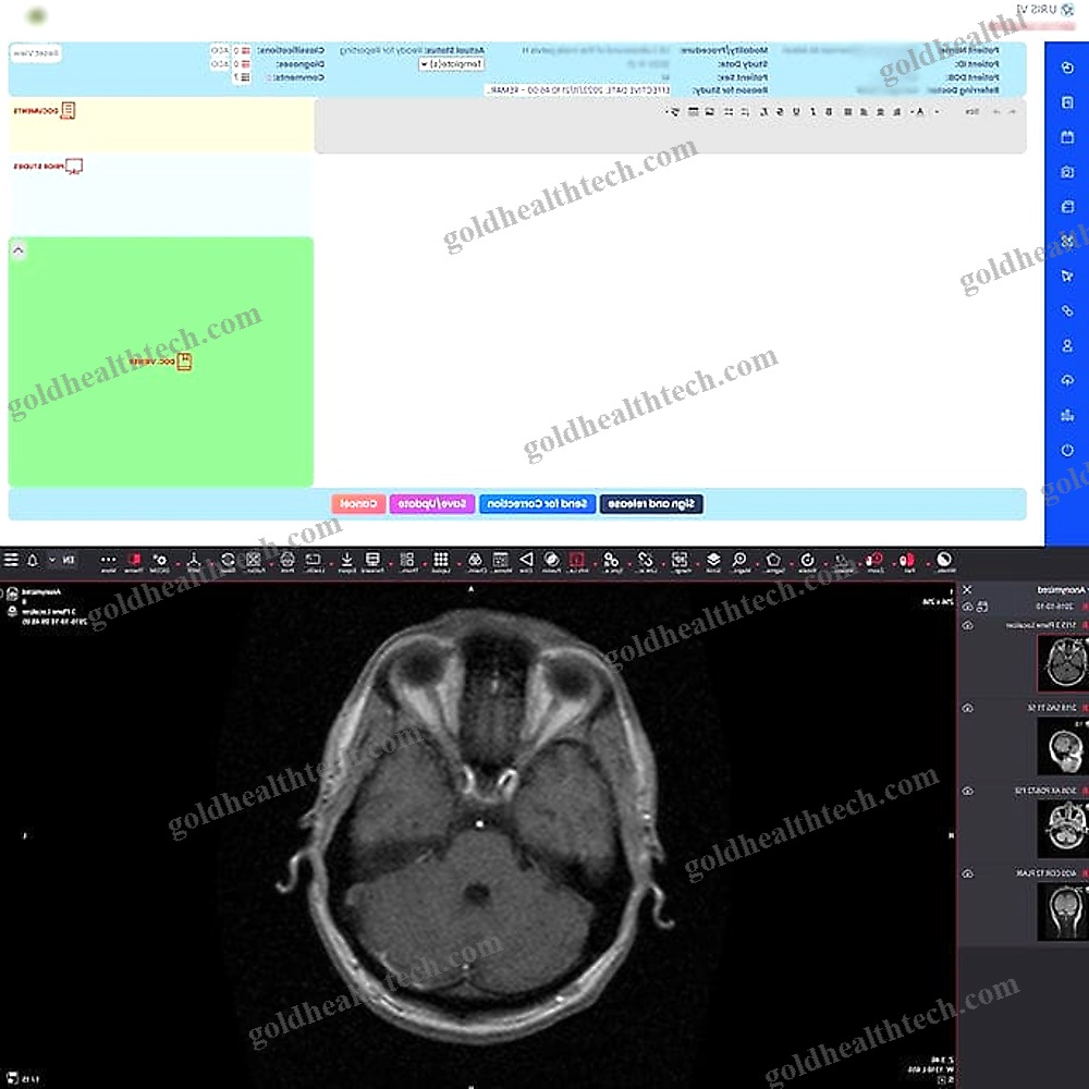 Web-Based Ris