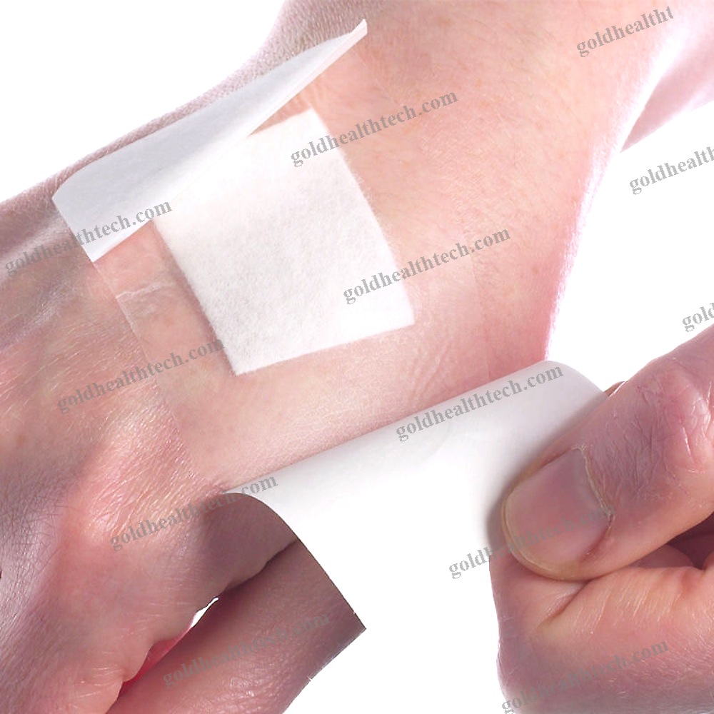Wound Dressing