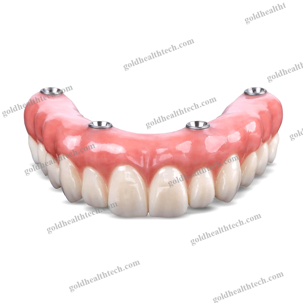 Zirconia Dental Prosthesis