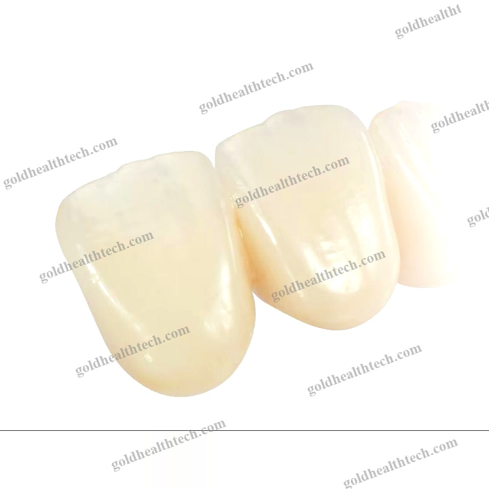 Zirconia Dental Prosthesis